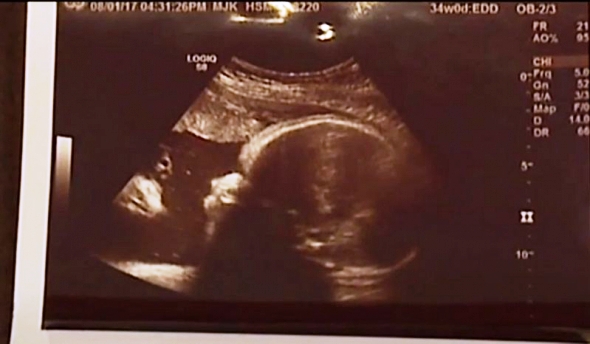 Pareja asegura que Jesús aparece observando a su bebé en ultrasonido